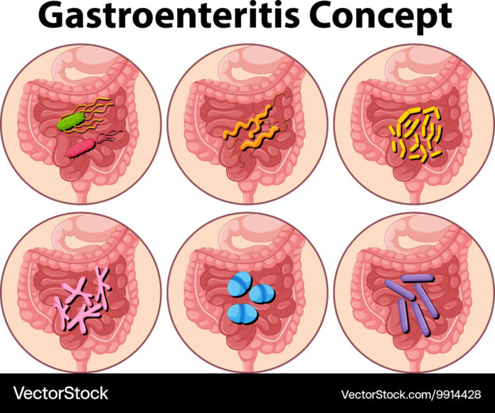 Gastroenteritis